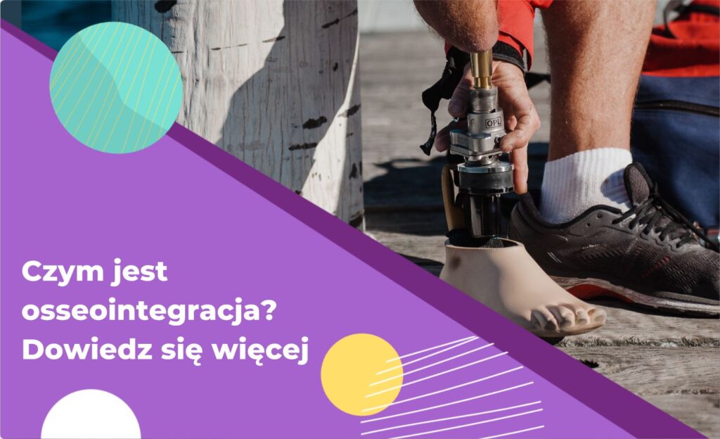 Czym jest osseointegracja? Dowiedz się, jak ta innowacyjna metoda wpłynęła na implantologię