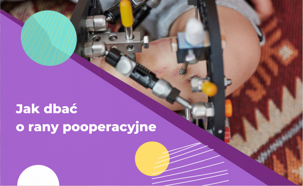 Jak dbać o rany pooperacyjne: Kompletny przewodnik | Blog - Paley ...